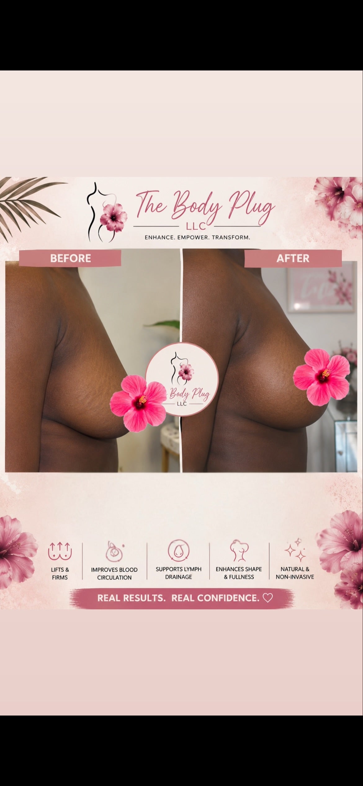 Breast Enhancers
