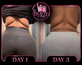 Liquid Lipo
