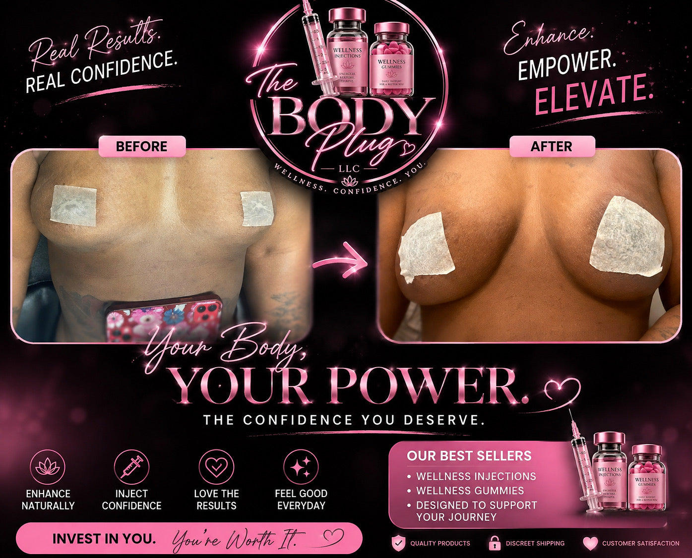 Breast Enhancers