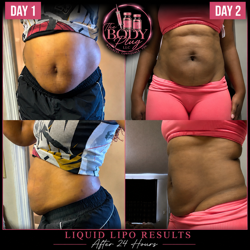 Liquid Lipo